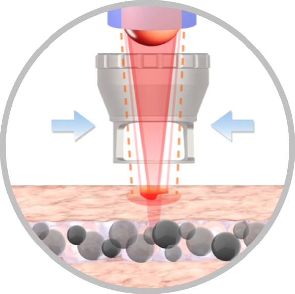 Thermal Lensing Effect